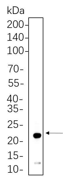 Anti-Human/Mouse/Rat NDUFB8 Antibody [B1142]