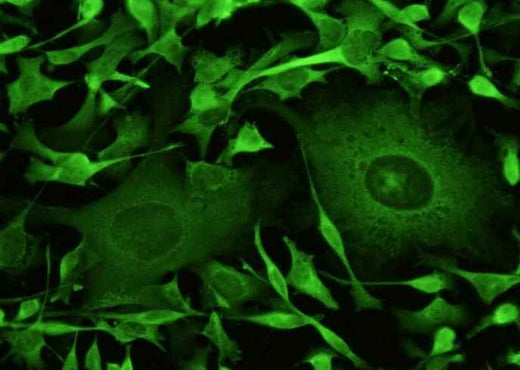 Anti-Human SOD1 Antibody [A1147] - ABMIUM