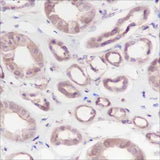 Anti-Human Calpain small subunit 1 Antibody [A148]
