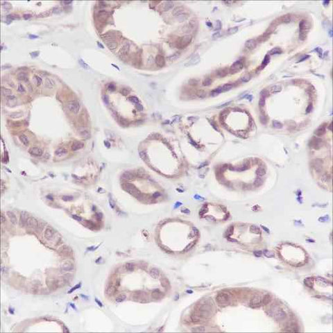 Anti-Human Calpain small subunit 1 Antibody [A148] - ABMIUM