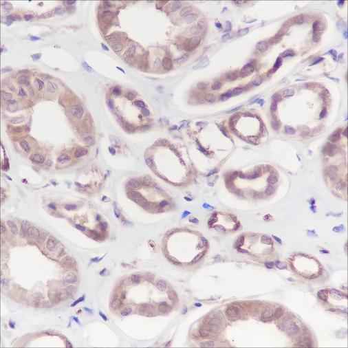 Anti-Human Calpain small subunit 1 Antibody [A148] - ABMIUM