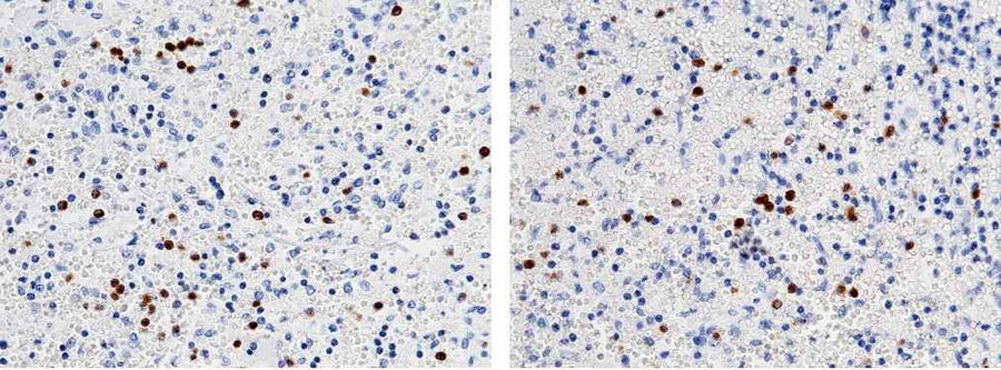 Anti-Human FCN1 Antibody [B129]