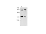 Anti-Human CDKN2A Antibody - ABMIUM