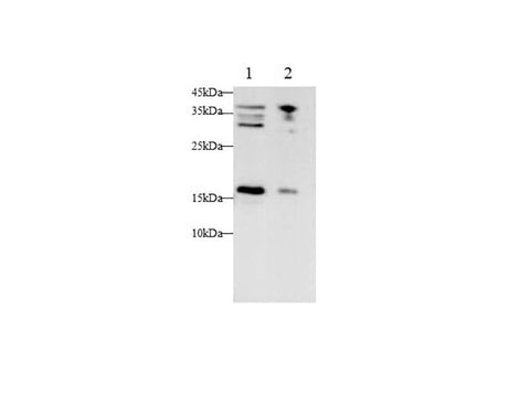 Anti-Human CDKN2A Antibody - ABMIUM