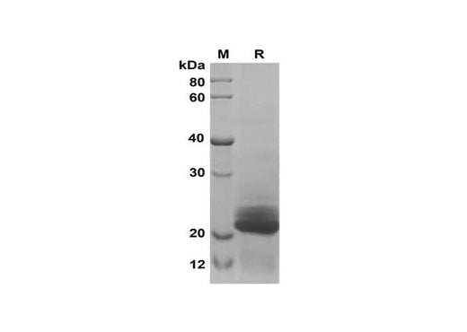 SDS-PAGE analysis of Human Angiogenin proteins, 2 μg/lane of Recombinant Human Angiogenin proteins was resolved with SDS-PAGE under reducing conditions, showing bands at 24 kDa.