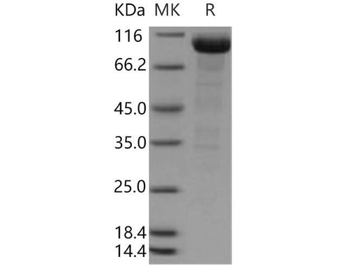 > 83 % as determined by reducing SDS-PAGE.