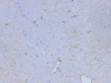 Anti-Rat S100B Antibody - ABMIUM