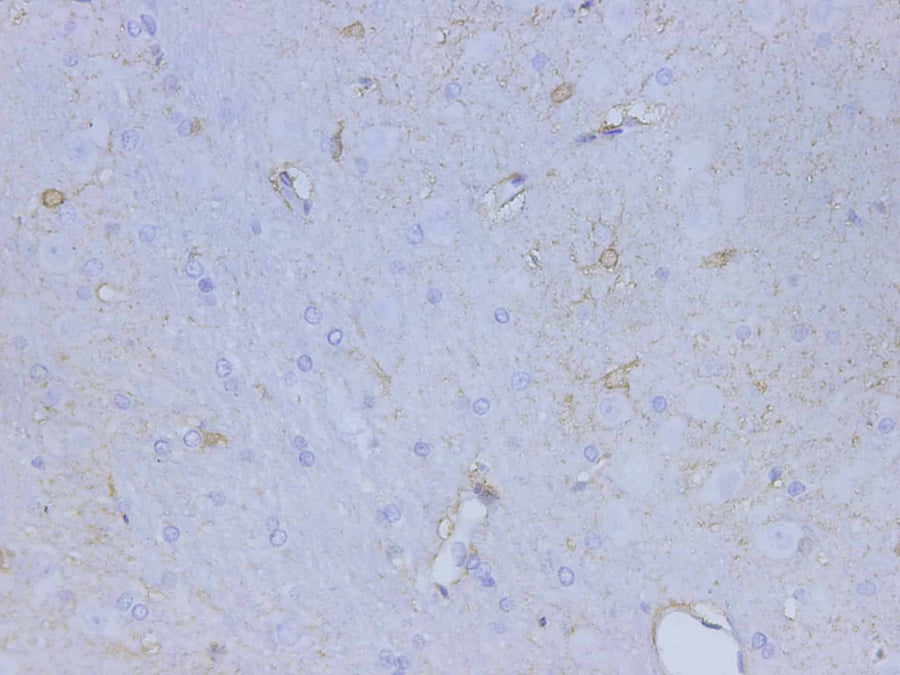Anti-Rat S100B Antibody - ABMIUM