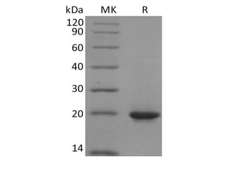 Recombinant Human Sonic Hedgehog/SHH (C-6His) - ABMIUM