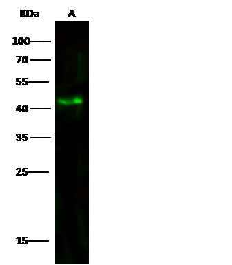 Anti-Human ACY1 Antibody [A1032] - ABMIUM