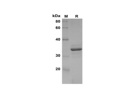 SDS-PAGE analysis of Human Q96PH1 proteins, 2 μg/lane of Recombinant Human Q96PH1 proteins was resolved with SDS-PAGE under reducing conditions, showing bands at 35 kDa.