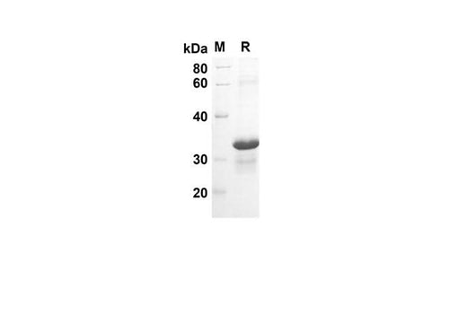 SDS-PAGE analysis of Human AREG proteins, 2 μg/lane of Recombinant Human AREG proteins was resolved with an SDS-PAGE under reducing conditions, showing bands at 29 kDa.