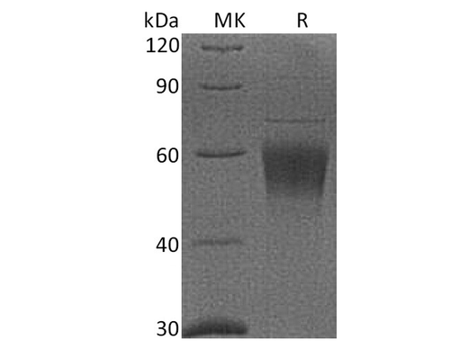 Recombinant Cynomolgus CRTAM/CD355 Protein (His Tag) - ABMIUM