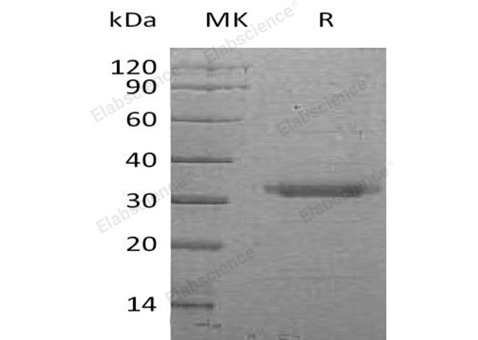 Recombinant Human PRSS22/BSSP-4 Protein (His Tag) - ABMIUM