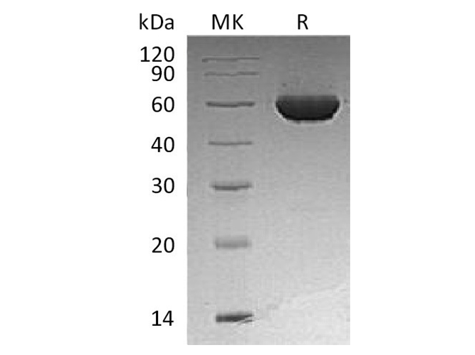 Recombinant Human ALDH1A2 Protein (His Tag) - ABMIUM