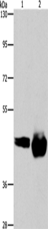Anti-Human CD38 Antibody - ABMIUM
