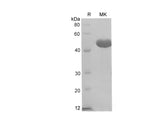 SDS-PAGE analysis of Rat Ceacam1/BGP-1 proteins, 2 μg/lane of Recombinant Rat Ceacam1/BGP-1 proteins was resolved with SDS-PAGE under reducing conditions, showing bands at 40-50 kDa.