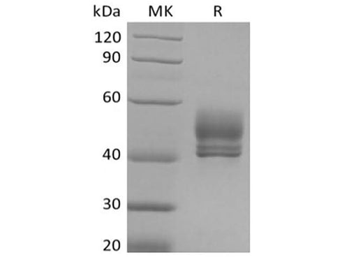 Recombinant Cynomolgus CD3D&CD3E Heterodimer (C-Fc-Flag&C-Fc-6His) - ABMIUM