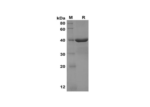 SDS-PAGE analysis of Human NUCB2 proteins, 2 μg/lane of Recombinant Human NUCB2 proteins was resolved with SDS-PAGE under reducing conditions, showing bands at 40 kDa.