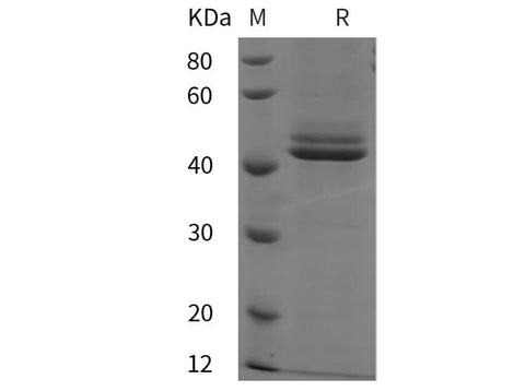 SDS-PAGE analysis of Rat Interleukin-12 subunit beta/IL-12B proteins, 2 μg/lane of Recombinant Rat Interleukin-12 subunit beta/IL-12B proteins was resolved with SDS-PAGE under reducing conditions, showing bands at 42 kDa.