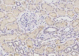 Anti-Human PHYH Antibody [A985] - ABMIUM