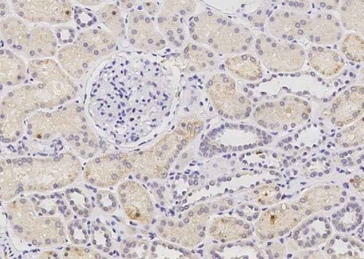 Anti-Human PHYH Antibody [A985] - ABMIUM