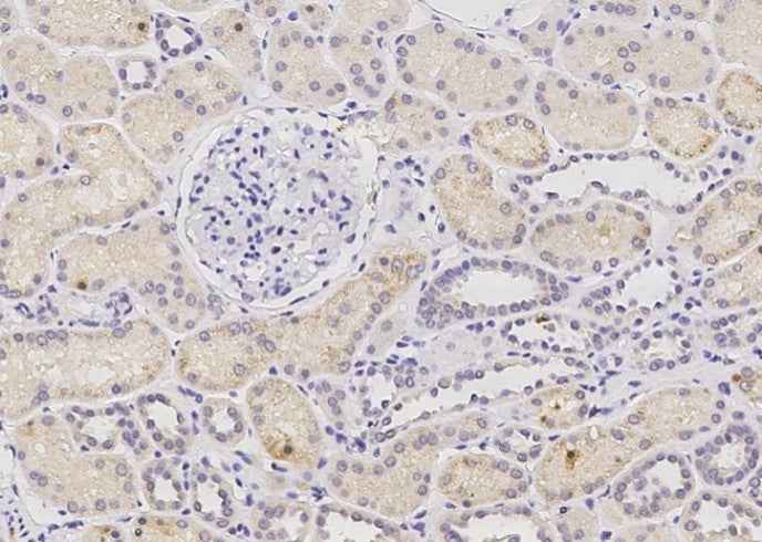 Anti-Human PHYH Antibody [A985] - ABMIUM