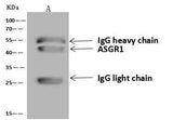 Anti-Human ASGR1 Antibody [B124]