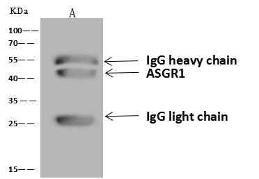 Anti-Human ASGR1 Antibody [B124] - ABMIUM