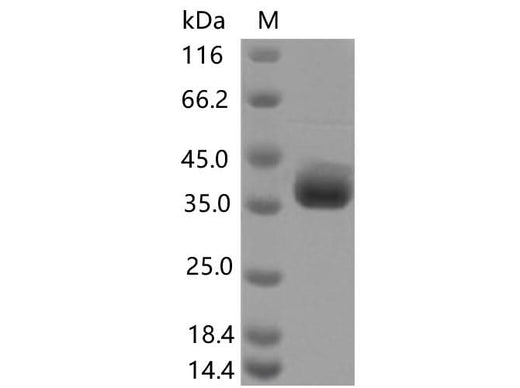 > 80 % as determined by reducing SDS-PAGE.