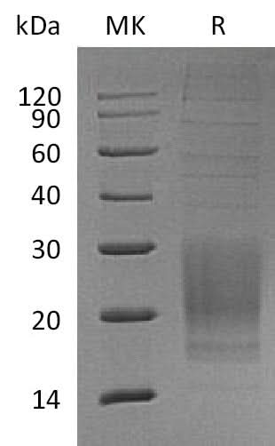 Recombinant Mouse ICOS/AILIM Protein (His Tag) - ABMIUM