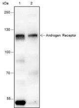 Anti-Human/Rat/Mouse Androgen Receptor Antibody [A132]