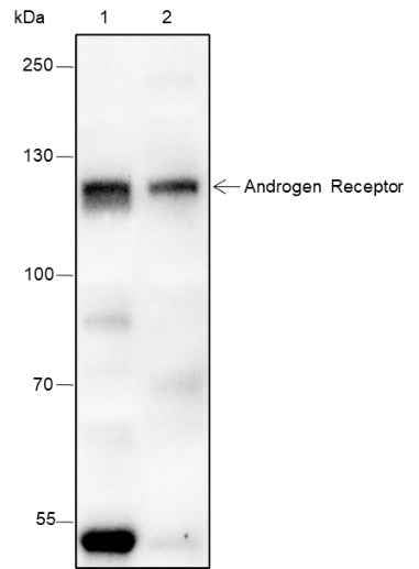 Anti-Human/Rat/Mouse Androgen Receptor Antibody [A132]