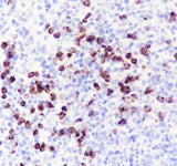 Anti-Human/Rat/Mouse MMP8 Antibody [A579]