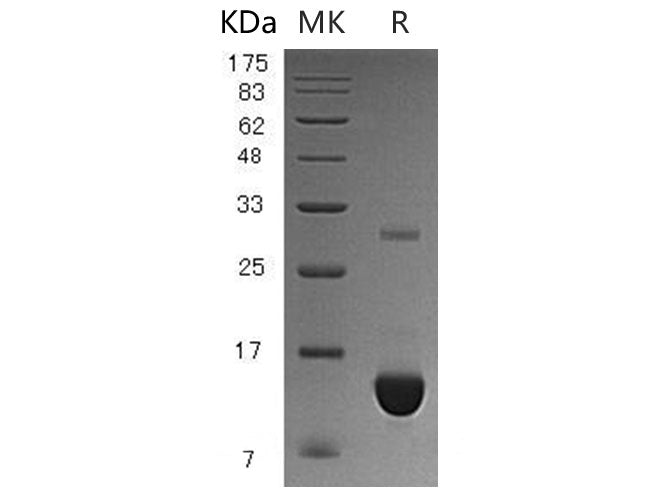 Recombinant Human S100P/S100E Protein (His Tag) - ABMIUM