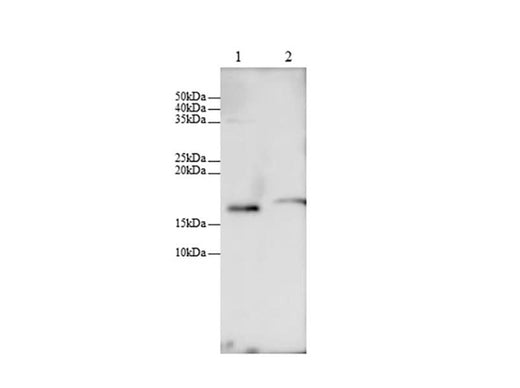 Anti-Mouse/Rat CCL25 Antibody - ABMIUM