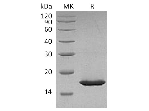 Recombinant Carassiusauratus Leptin Protein (His Tag) - ABMIUM