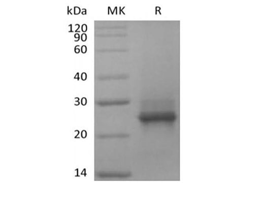 Recombinant Human KRAS(G12C, N-6His) - ABMIUM