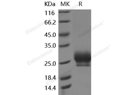 Recombinant Human RNF43 Protein (His Tag) - ABMIUM