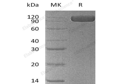 Recombinant Human NCAM1 Protein (His Tag) - ABMIUM