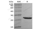 Recombinant Human TMPO Protein (His Tag) - ABMIUM