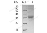 Recombinant Human Choriogonadotropin Subunit Beta 3/CGB3 Protein (His Tag) - ABMIUM