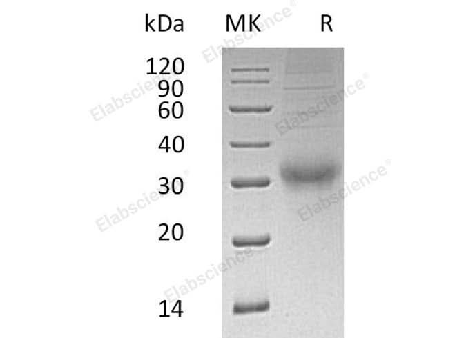 Recombinant Human Choriogonadotropin Subunit Beta 3/CGB3 Protein (His Tag) - ABMIUM