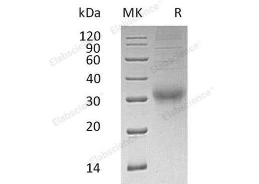 Recombinant Human Choriogonadotropin Subunit Beta 3/CGB3 Protein (His Tag) - ABMIUM