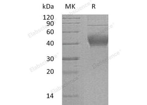 Recombinant Human IL-22BP/IL22RA2 Protein (His Tag) - ABMIUM