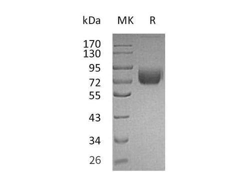 Recombinant Mouse IFNGR1 Protein (Fc Tag) - ABMIUM