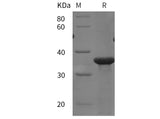 SDS-PAGE analysis of Human TGFBR3/ Betaglycan proteins, 2 μg/lane of Recombinant Human TGFBR3/ Betaglycan proteins was resolved with SDS-PAGE under reducing conditions, showing bands at 35 kDa.