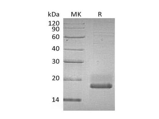 Recombinant Human SUMO3/SMT3A Protein (aa 2-92, His Tag) - ABMIUM