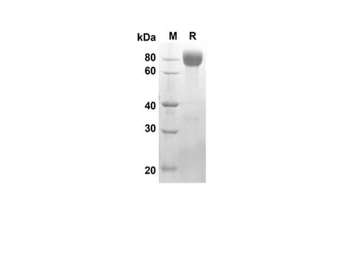 SDS-PAGE analysis of Rat CD62L/L-Selectin proteins, 2 μg/lane of Recombinant Rat CD62L/L-Selectin proteins was resolved with SDS-PAGE under reducing conditions, showing bands at 57.5 kDa.
