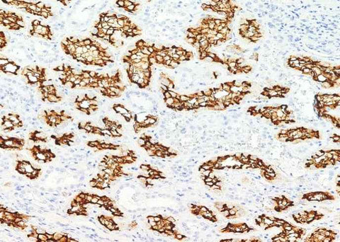 Anti-Human ACE2 Antibody [A1137] - ABMIUM
